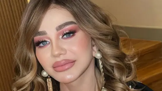 أطلت بوجه مشدود وشفاه ممتلئة.. ميادة الحناوي تقلب مواقع التواصل