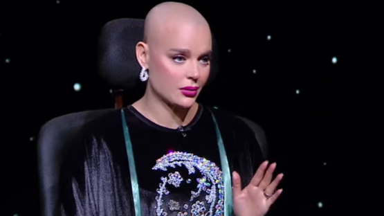 أستأصلَت 3 أورام.. هبة السيسي: سقوط الشعر أصعب لحظة في علاج السرطان